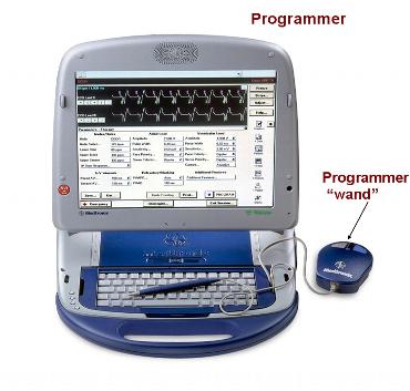 implantable cardioverter defibrillator medtronic