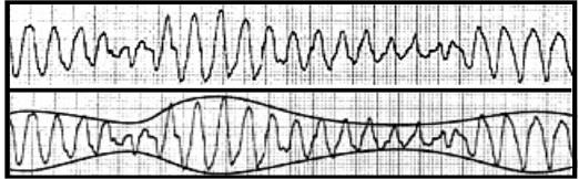 tdP-strip-collage